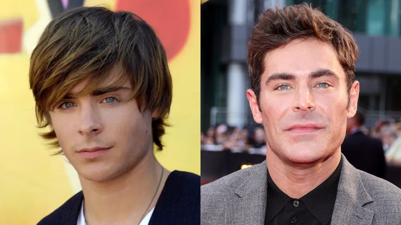O que realmente aconteceu com o rosto de Zac Efron? Ator relembra acidente grave e boatos de cirurgia plástica – Notícias de cinema